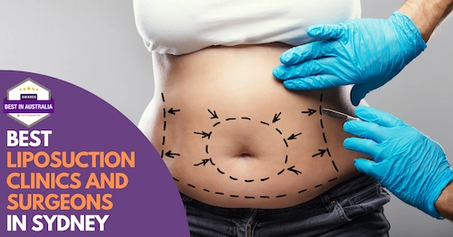 Best Liposuction Sydney