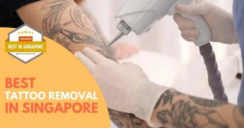 Best Tattoo Removal Singapore 