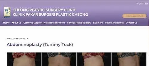 Cheong Plastic Surgery Specialist Clinic - Tummy Tuck KL Selangor