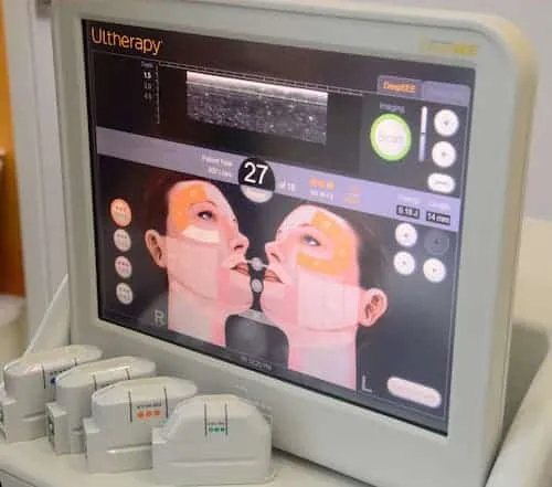 Halley Medical Aesthetics - Ultherapy Singapore (Credit: Halley Medical Aesthetics) 