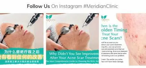 Meridian Clinic  - Ultherapy KL Selangor 