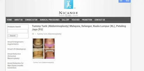 Nicanor Plastic & Cosmetic Surgery - Tummy Tuck KL Selangor