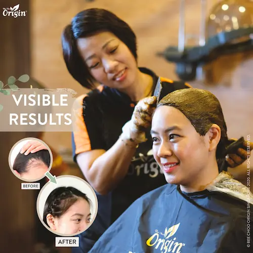  Bee Choo Origin - Hair Loss Treatment Singapore   