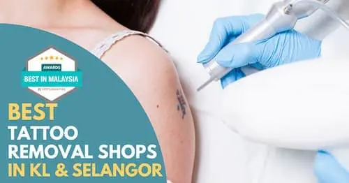 Best Tattoo Removal KL Selangor