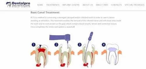 Dentalpro Dental Specialist Centre - Root Canal Treatment KL Selangor