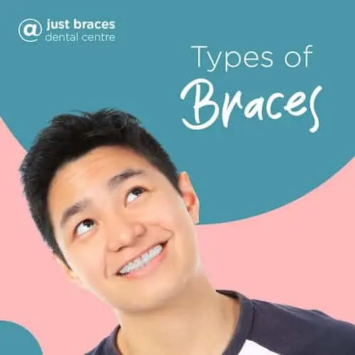 Just Braces Dental Centre - Ceramic Braces Singapore