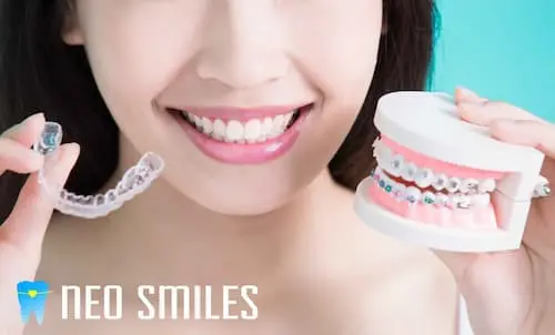 Neo Smiles Dental Studio - Ceramic Braces Singapore