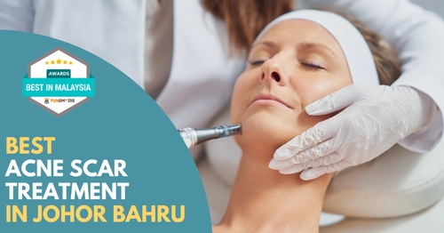 Best Acne Scar Treatment Johor Bahru 