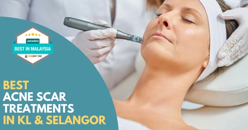 Best Acne Scar Treatment KL Selangor 