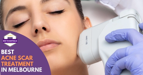 Best Acne Scar Treatment Melbourne