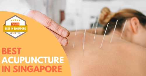 Best Acupuncture Singapore 