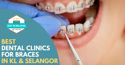 Best Braces KL Selangor