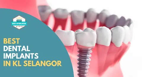 Best Dental Implants KL Selangor