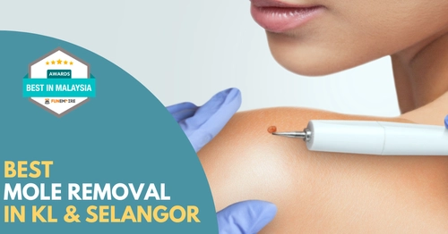 Best Mole Removal KL Selangor 