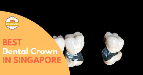 Best Dental Crown Singapore 